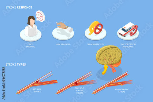 3D Isometric Flat Vector Conceptual Illustration of Brain Blood Supply Problem, Ischemic Stroke Attack