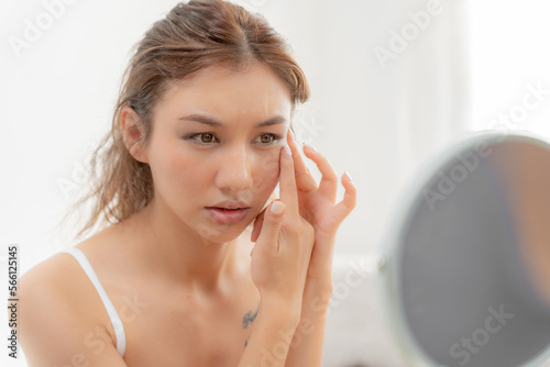 Young woman asian are worried about faces Dermatology and allergic to steroids in cosmetics. sensitive skin,red face from sunburn, acne,allergic to chemicals,rash on face. skin problems and beauty photo