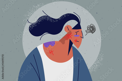 Unhappy woman with bruises and beatings 