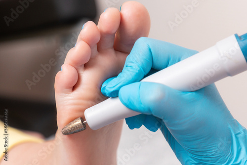 Pedicurist does hardware peeling of the skin of the female foot. Close-up. The concept of professional chiropody and podology