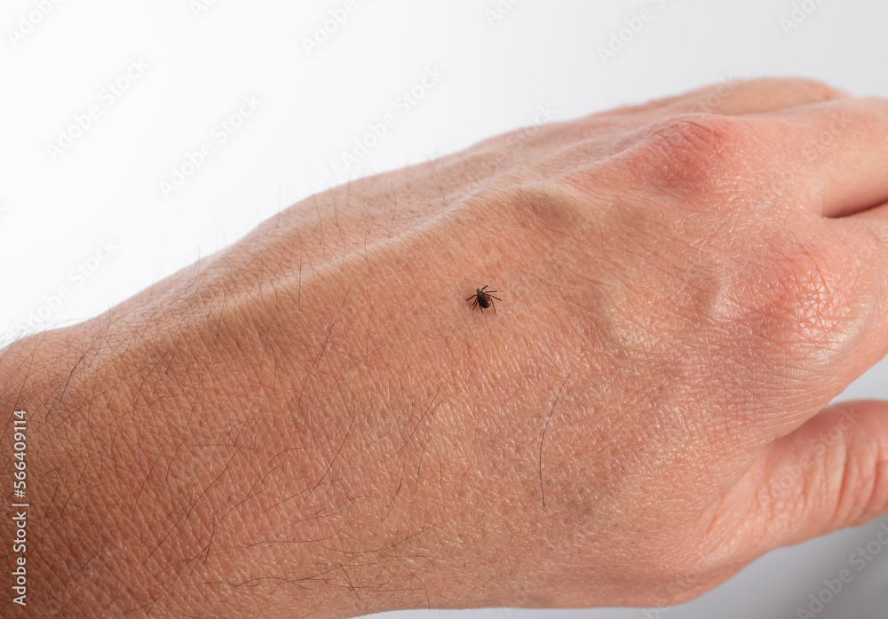 Fototapeta premium Zecke auf der Hand