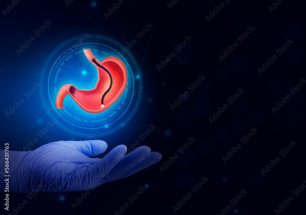 Endoscopic biopsy, esophagogastroduodenoscopy, EGD. Human stomach