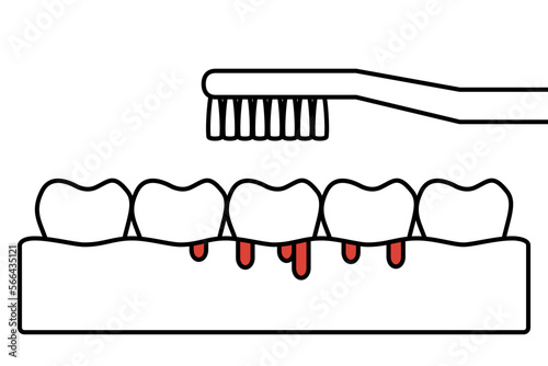 gingivitis or scurvy, brushing teeth with bleeding on gum and tooth - dental cartoon vector outline flat style