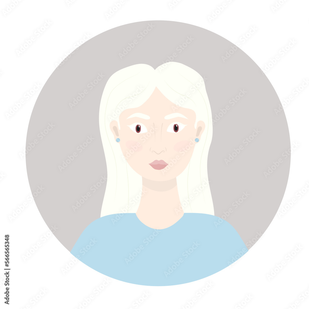 International women's day concept. Beautiful albino women, vector illustration in flat style