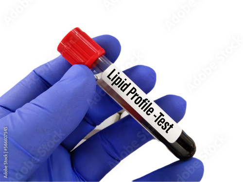 Blood sample for Lipid profile, Triglyceride, HDL and LDL test. Copy space on white background photo