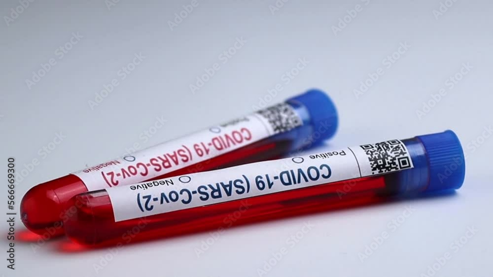 Flaks with blood tests for coronavirus positive and negative, mpox Flaks with blood tests for coronavirus positive and negative, mpox