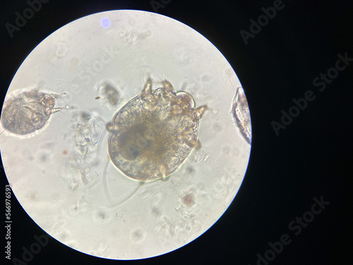 Notoedres cati under the microscope. Notoedric mange, also referred to as Feline scabies.