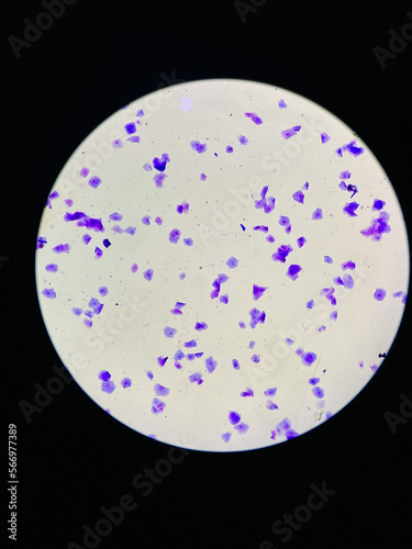 View in microscopic of dog vaginal smear cells.Squamous epithelium cells.Superficial and intermediate epithelial cells.