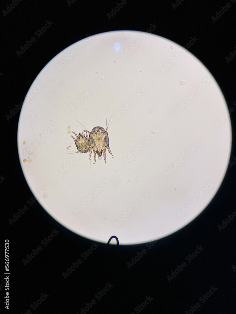 Otodectes cynotis, or ear mites under the microscope. This mites are found in cat's ear. it can