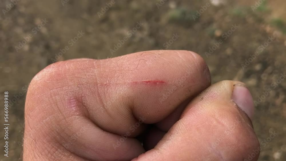 Fresh wound with blood on the finger Fresh wound with blood on the finger