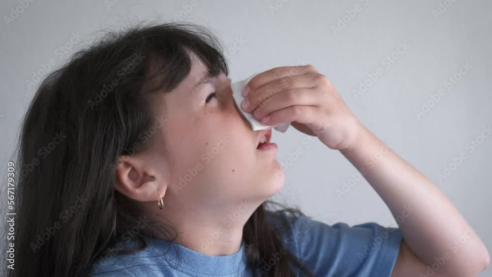 The child is bleeding from the nose. The little girl threw her head up