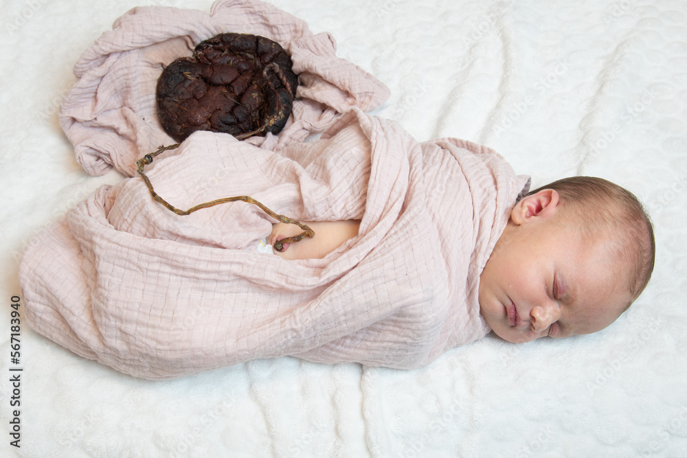 Newborn baby with placenta still connected to baby after 6 days. Photo ...