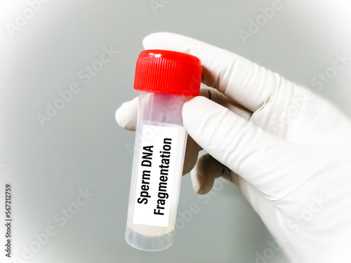 Fotografi Scientist holding sample container with Sperm for DNA Fragmentation test