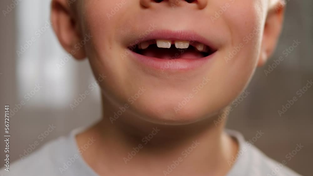 Close-up of the baby's milk and new molars. The boy smiles and shows his fallen baby teeth. Close-up of the baby's milk and new molars. The boy smiles and shows his fallen baby teeth.