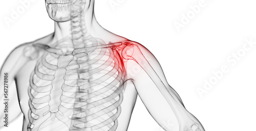 Plakat w ramie 3d rendered medical illustration of a man with shoulder pain