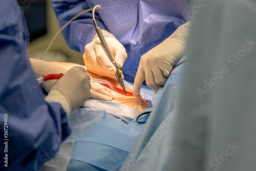 A chief physician in cardiac surgery opens the chest with an electronic scalpel in order to be able to create a bypass on the heart. Concept: health and cardiac surgery