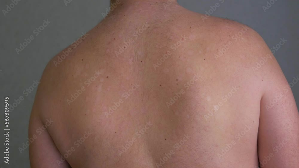 Man with healthy back on white background. Visiting orthopedist