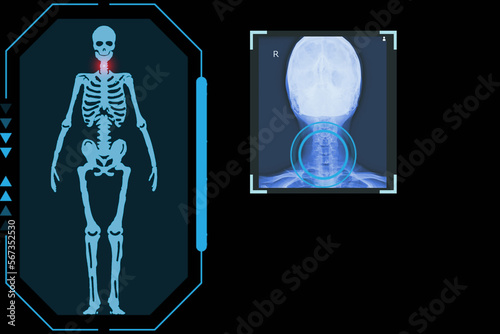 Examines a technological digital holographic plate representing the patient's body, Cervical spine, Concept: Futuristic medicine, Medical technology concept.