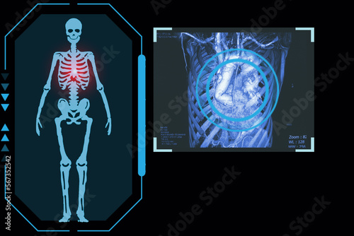 Examines a technological digital holographic plate representing the patient's body, Chest and cardio-thorax , Concept: Futuristic medicine, Medical technology concept.