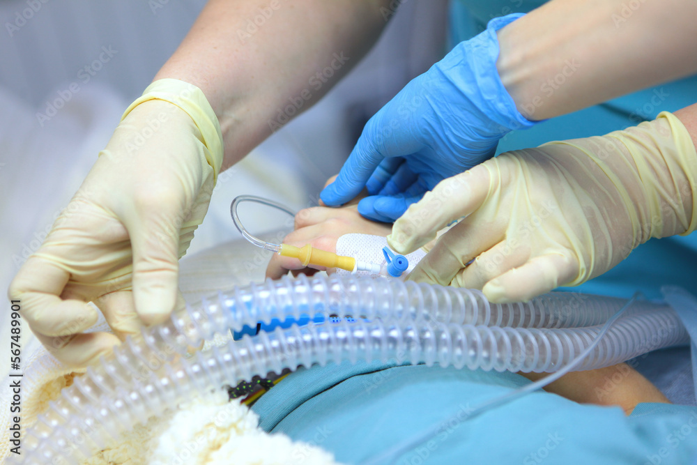 Preparing the child for anesthesia. Dental surgery under general