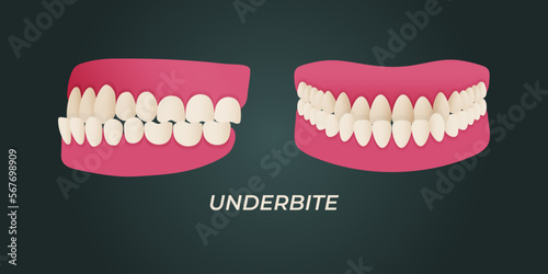 Medical dental diagram illustration. Orthodontist human tooth anatomy. Vector infographics with teeth diagrams.