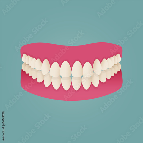 Human teeth malocclusion set with realistic images of mouth jaws with crooked teeth and text captions. Normal and abnormal occlusion. Vector illustration