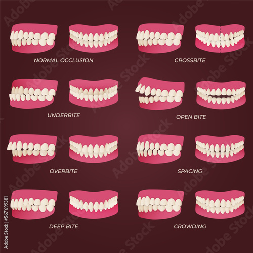Medical dental diagram illustration. Orthodontist human tooth anatomy. Vector infographics with teeth diagrams.