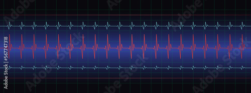 3d editable stroke ecg, ekg monitor with cardio diagnosis illustration. Heart rhythm line vector design to use in healthcare, healthy lifestyle, medicine, heart attack illustration projects. 