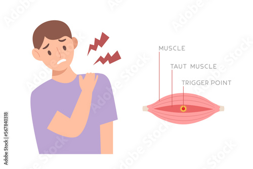 Young man suffering from neck and shoulder muscle stiffness with trigger point in muscle diagram isolated on white background. Concept of muscle pain, office syndrome, painful face expression.