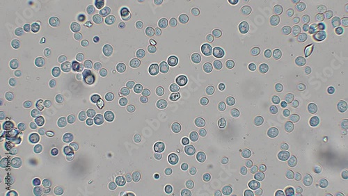 yeast cells under the microscope (bakery yeast) - optical microscope x1000 magnification photo