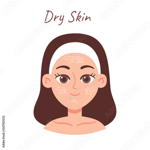 Skin Type illustration. Dry skin