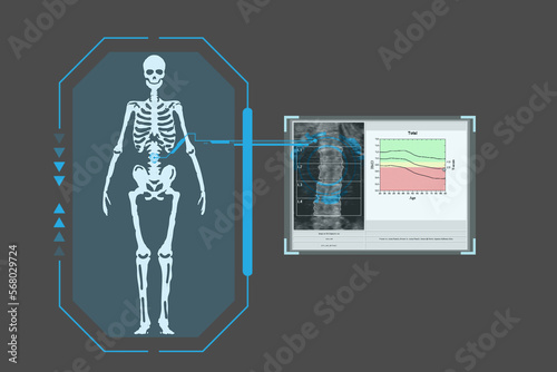 Examines a technological digital holographic plate representing the patient's body, results of densitometry , Concept: Futuristic medicine, Medical technology concept.