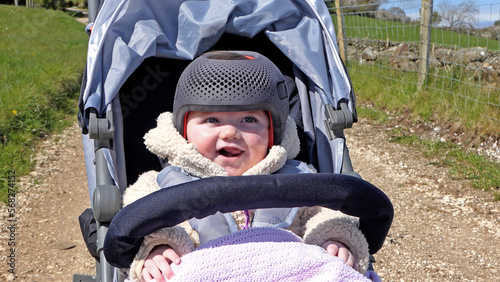 Baby girl wearing a cranial remoulding helmet for flat head photo