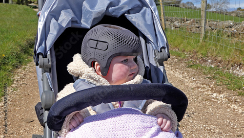 Baby girl wearing a cranial remoulding helmet flat head photo