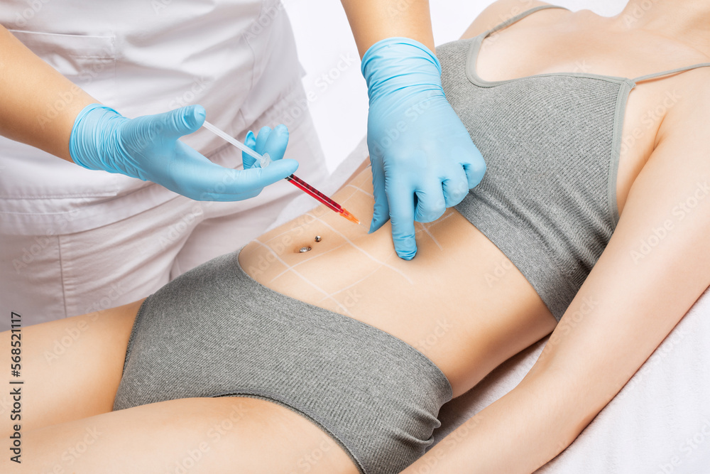lipolytic injections to burn body fat on a woman’s body, legs and thighs. Female aesthetic cosmetology in a beauty salon. lipolytic injections to burn body fat on a woman’s body, legs and thighs. Female aesthetic cosmetology in a beauty salon.