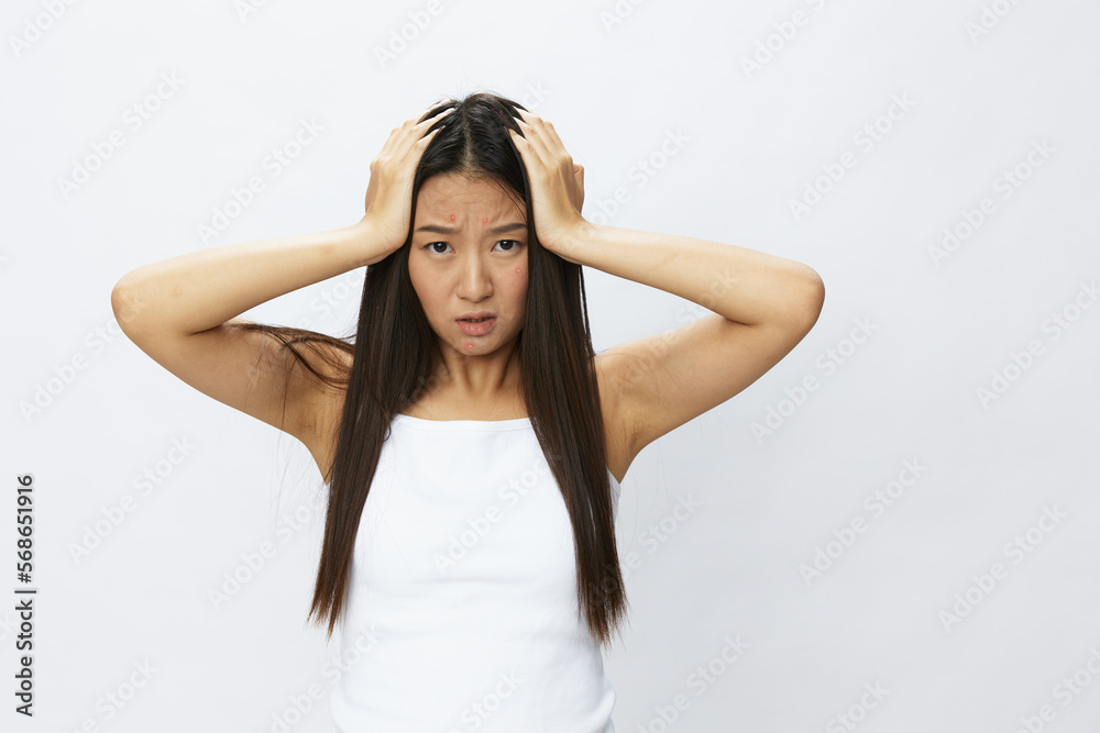 Asian woman facial skin problems, acne and inflammation, red rashes and allergies, chicken pox, sadness from rashes. Facial skin care concept for diseases and nerves Asian woman facial skin problems, acne and inflammation, red rashes and allergies, chicken pox, sadness from rashes. Facial skin care concept for diseases and nerves