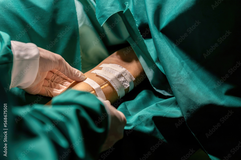 doctor putting medical tape tube patient for infusion operation. expert