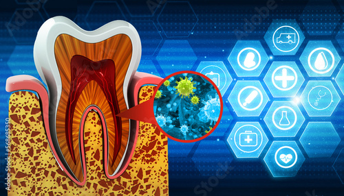 Human tooth bacterial infection. 3d illustration.. photo