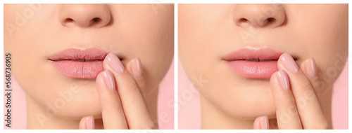 Obraz na płótnie Collage with photos of woman before and after using lip balm on pink background,