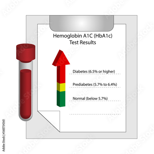 Hemoglobin A1C, HbA1c test results, glycated hemoglobin, A1C Blood Sugar Test, Diabetes Mellitus. Vector illustration.	