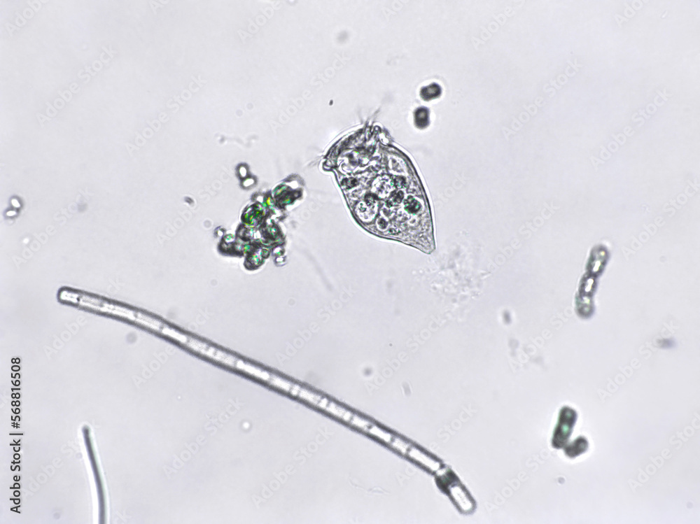 Freshwater aquatic zooplankton and algae under microscope view Stock ...