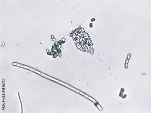 Freshwater aquatic zooplankton and algae under microscope view