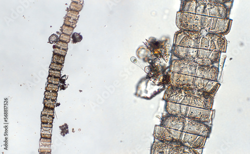 Freshwater aquatic zooplankton and algae under microscope view photo