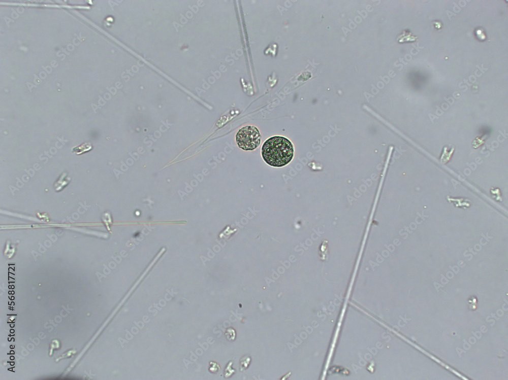 Diatoms, algae under microscopic view, phytoplankton, fossils, silica ...