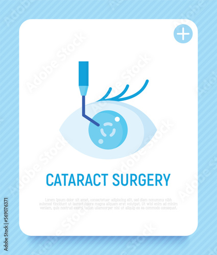 Cataract surgery flat icon. Ophthalmology. Lasik vision correction. Modern vector illustration.