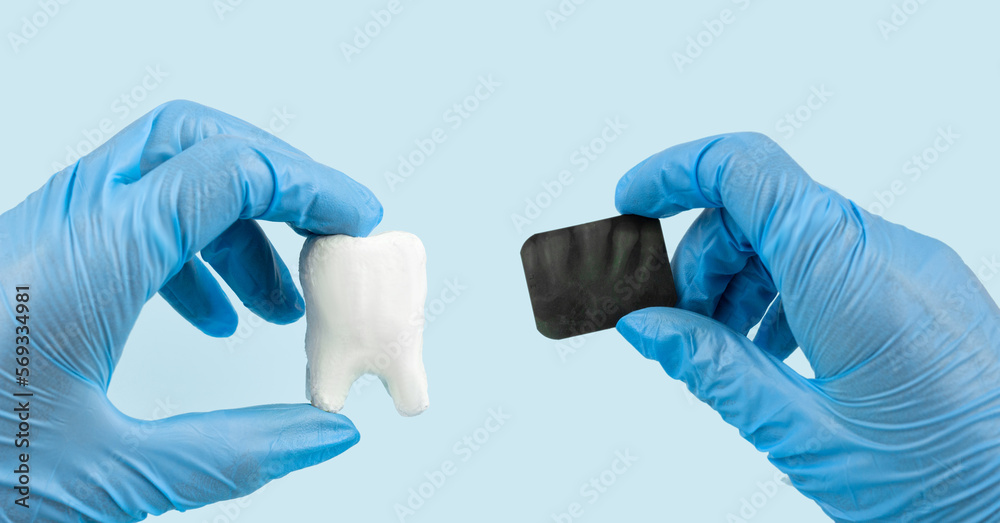 Female dentist hands holds a model tooth and x-ray of teeth. Light background. Concept of oral hygiene in the family. Female dentist hands holds a model tooth and x-ray of teeth. Light background. Concept of oral hygiene in the family.