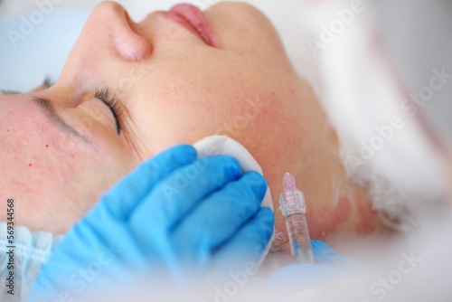 cosmetologist makes a mesotherapy or plasmolifting procedure for the patient. Biorevitalization is a method of preventing skin aging by microinjections of hyaluronic acid. photo