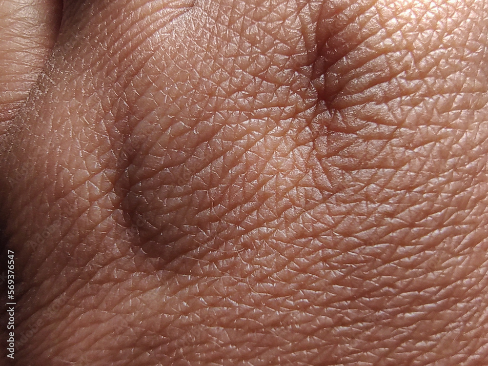 Fototapeta premium Hand skin texture, with dehydration, dryness, signs of age, mature skin, close up.