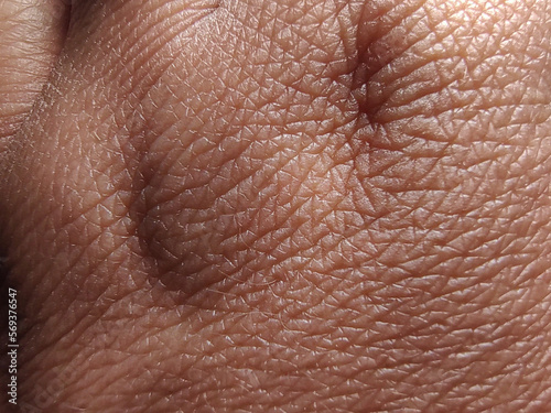Hand skin texture, with dehydration, dryness, signs of age, mature skin, close up.
