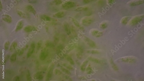 Euglena is a genus of single cell flagellate eukaryotes under microscopic view for study. photo